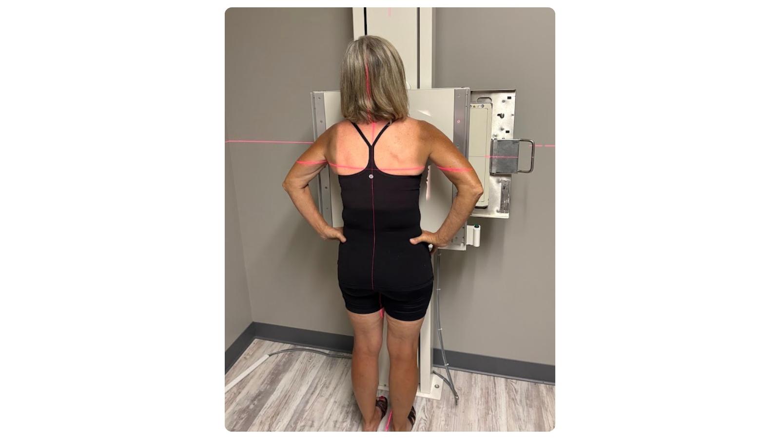 PA upright chest positioning